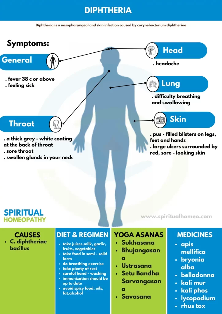 diphtheria