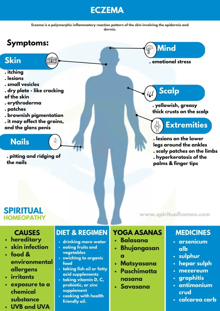 eczema
