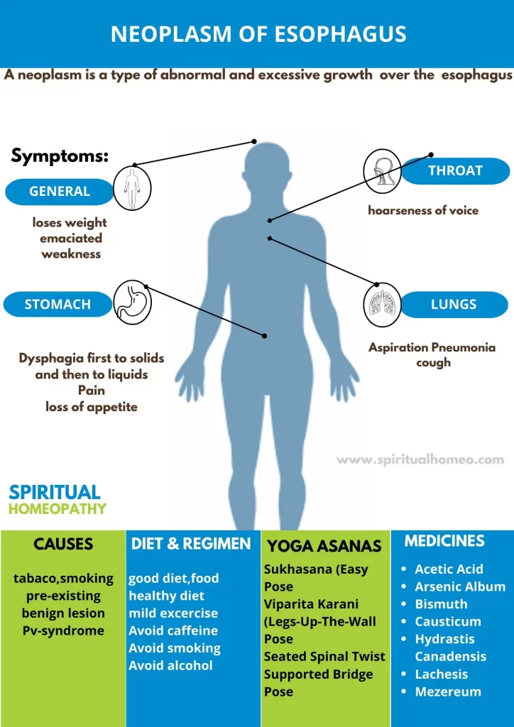 neoplasm-of-esophagus