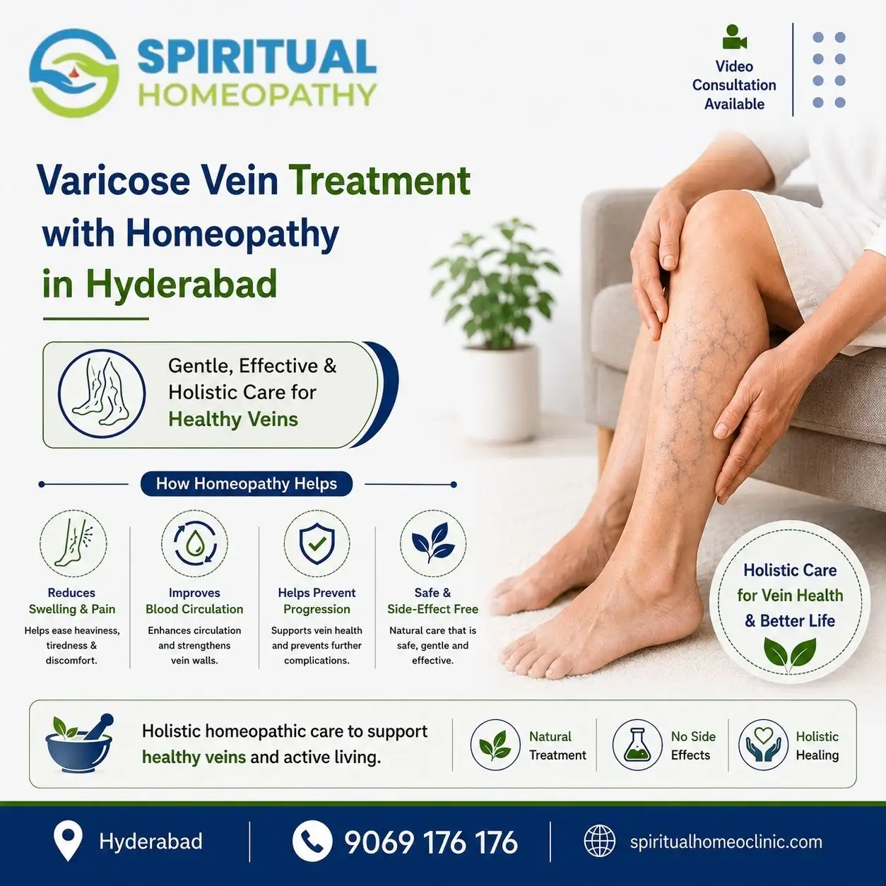 Varicose Vein Treatment with Homeopathy