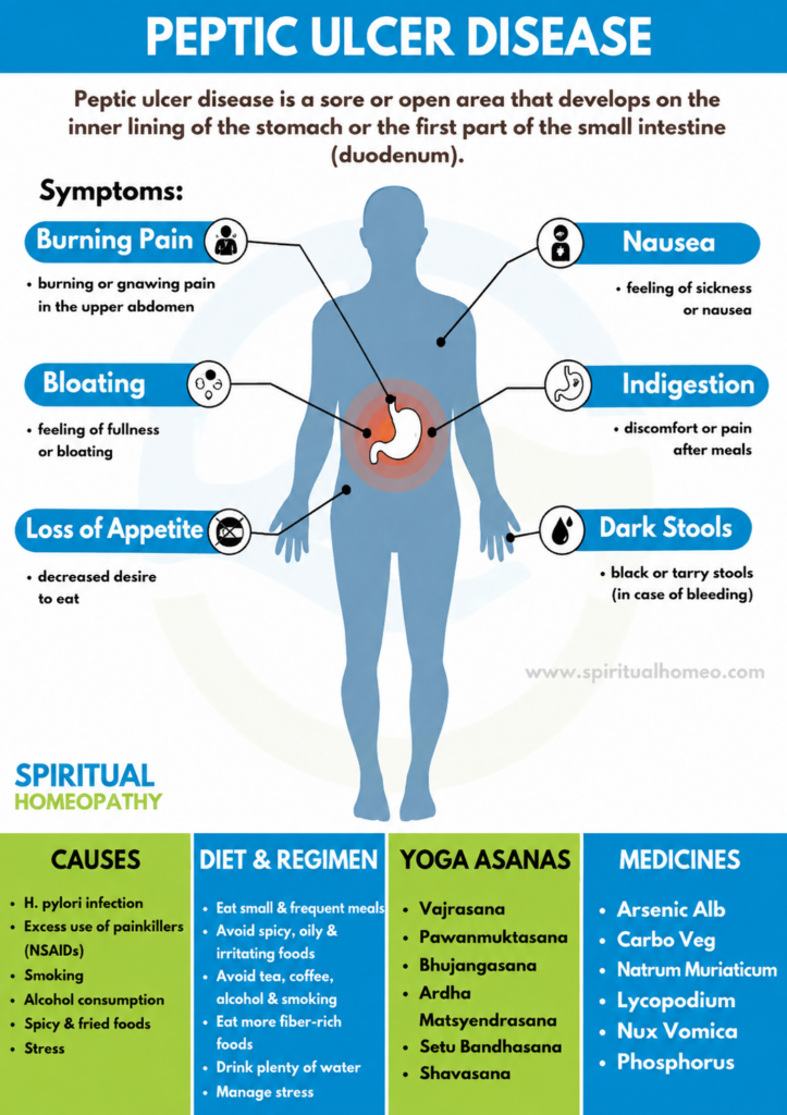 Understanding Peptic Ulcer Disease: A Homeopath’s Guide to Digestive Wellness